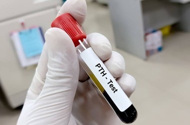 Parathormon (PTH) – badanie, normy, wskazania. Przyczyny i skutki niedoboru i nadmiaru hormonu przytarczyc