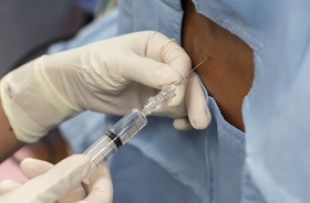 Punkcja lędźwiowa – wskazania, przebieg zabiegu i możliwe powikłania