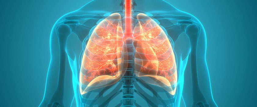 Zapalenie płuc – przyczyny, objawy, leczenie, powikłania u dzieci i u dorosłych