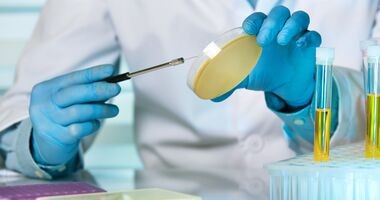 bakterie w moczu, posiew próbki moczu w laboratorium