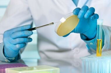 bakterie w moczu, posiew próbki moczu w laboratorium