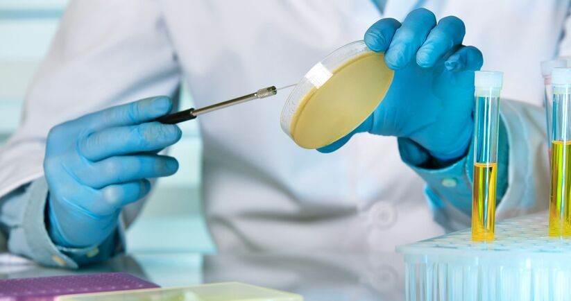 bakterie w moczu, posiew próbki moczu w laboratorium