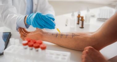 testy alergiczne, test na alergię, testy skórne na alergię, testy z krwi na alergię, lekarz wykonuje test alergiczny na ręce pacjenta
