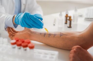 testy alergiczne, test na alergię, testy skórne na alergię, testy z krwi na alergię, lekarz wykonuje test alergiczny na ręce pacjenta
