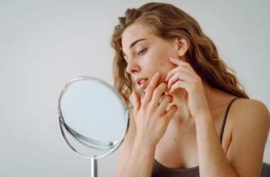 Trądzik grzybiczy – przyczyny, objawy, leczenie, pielęgnacja