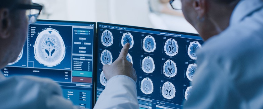 Lekarz analzuje tomograf komputrowy mózgu