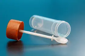 Badanie kału – pasożyty, krew utajona, resztki pokarmowe. Jak pobrać kał do badania?