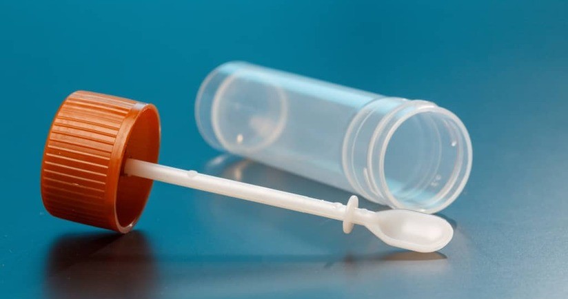 Badanie kału – pasożyty, krew utajona, resztki pokarmowe. Jak pobrać kał do badania?