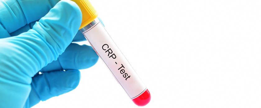 CRP – co oznacza CRP wysokie, a co CRP niskie? O jakich chorobach może świadczyć podwyższone CRP?