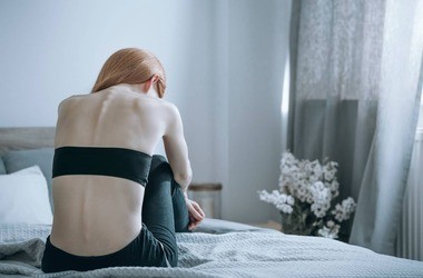 kobieta cierpiąca na anoreksję