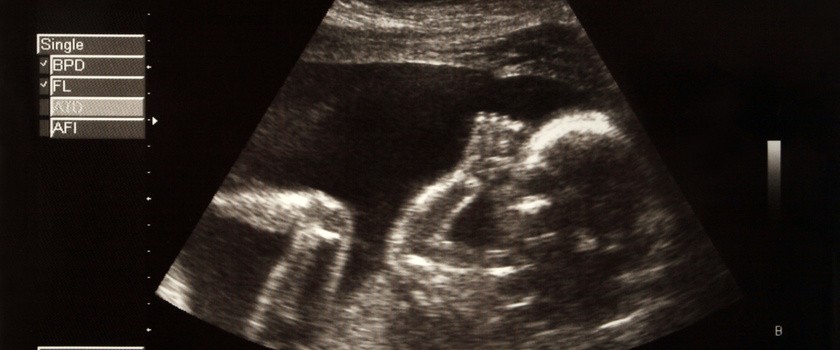 10. tydzień ciąży – jak wygląda dziecko i co dzieje się z mamą?