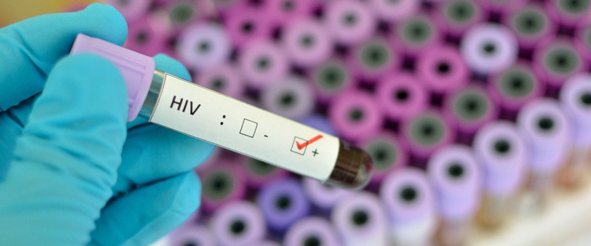Stworzono biomedyczną metodę zapobiegania HIV. Dopochwowy pierścień znacznie obniża ryzyko zakażenia