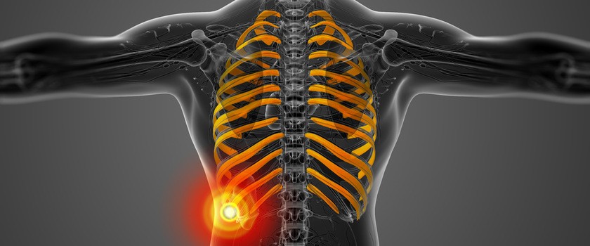 Ból żeber – przyczyny, diagnostyka, leczenie bólu żeber z lewej i prawej strony