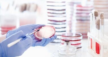 laborant wykonuje posiew bakterii, meningokoki