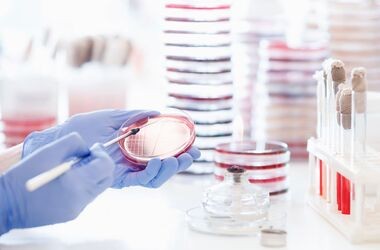 laborant wykonuje posiew bakterii, meningokoki