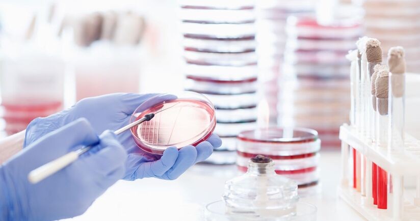 laborant wykonuje posiew bakterii, meningokoki