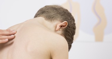 Skolioza – przyczyny, objawy, leczenie bocznego skrzywienia kręgosłupa. Ćwiczenia na skoliozę