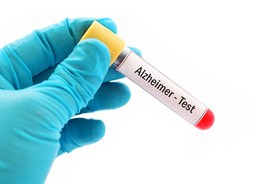 Test wykryje Alzheimera nawet z 20–letnim wyprzedzeniem