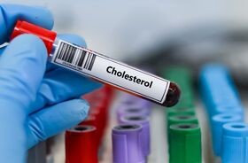 badanie poziomu cholesterolu, próbka krwi do badania cholesterolu
