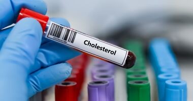 badanie poziomu cholesterolu, próbka krwi do badania cholesterolu
