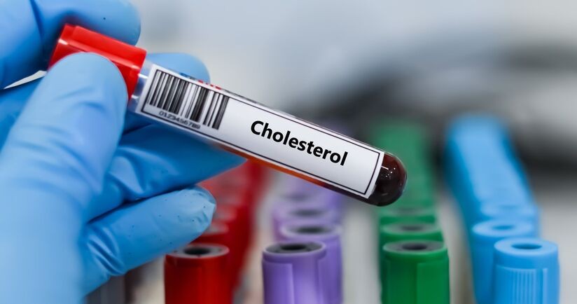 badanie poziomu cholesterolu, próbka krwi do badania cholesterolu