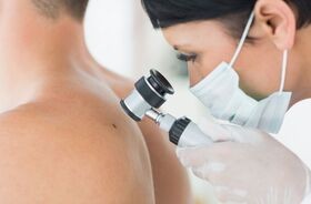 Czerniak to nowotwór złośliwy skóry. Każdy podejrzany pieprzyk powinien zobaczyć dermatolog.