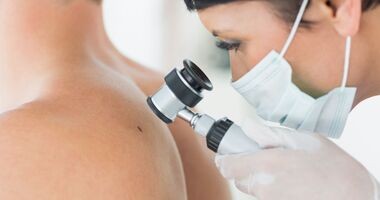 Czerniak to nowotwór złośliwy skóry. Każdy podejrzany pieprzyk powinien zobaczyć dermatolog.