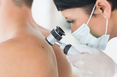Czerniak to nowotwór złośliwy skóry. Każdy podejrzany pieprzyk powinien zobaczyć dermatolog.