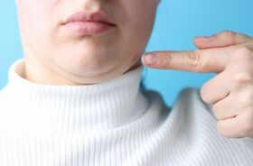 Kobieta z podwójnym podbródkiem, drugi podbródek, podwójny podbródek.