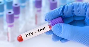 test na HIV, badanie na HIV, HIV w POZ, 