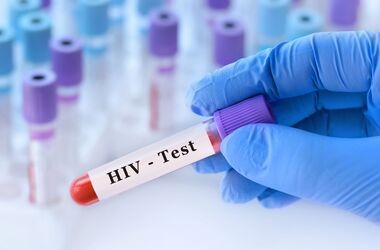 test na HIV, badanie na HIV, HIV w POZ, 