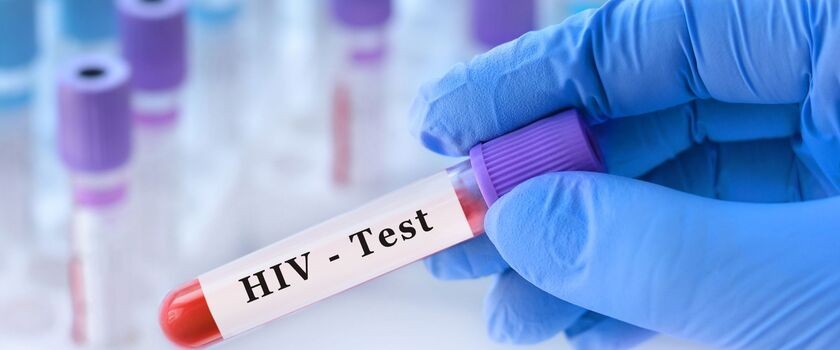 test na HIV, badanie na HIV, HIV w POZ,