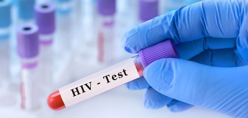 test na HIV, badanie na HIV, HIV w POZ, 