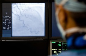 Angiografia tętnic wieńcowych — sprawdź, jak przebiega koronarografia i jak się do niej przygotować