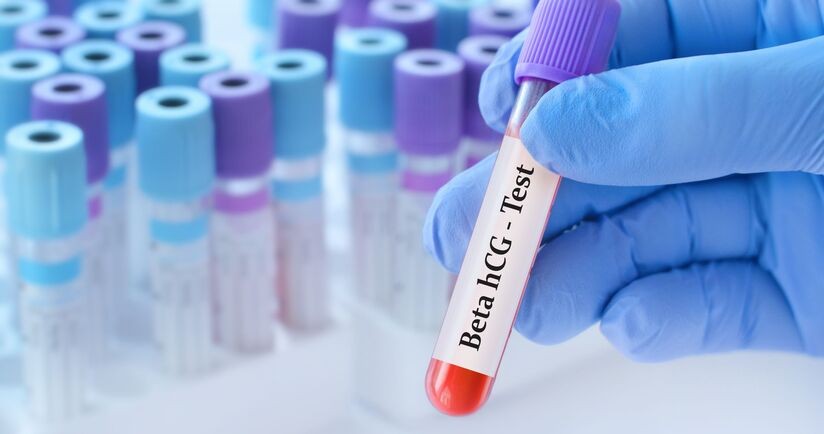 test na betaHCG, bHCG, poziom beta-HCG, test beta-HCG, beta-HCG w ciąży, beta-HCG bez ciąży