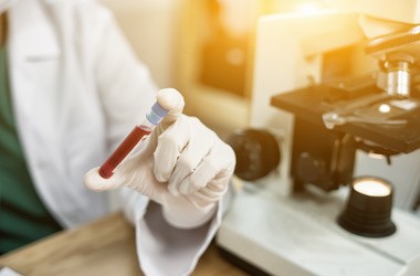 Jakie badania z krwi są najpopularniejsze? Które warto wykonywać regularnie?