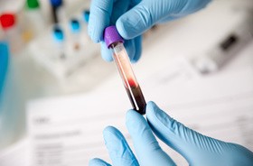 Krew krwi nierówna: jak rozpoznać tę najlepszą do transfuzji?