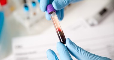 Krew krwi nierówna: jak rozpoznać tę najlepszą do transfuzji?