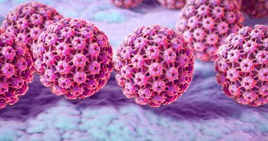 HPV (wirus brodawczaka ludzkiego) – przyczyny, objawy, rozpoznanie, leczenie zakażenia wirusem HPV