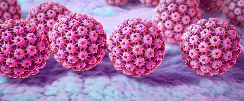HPV (wirus brodawczaka ludzkiego) – przyczyny, objawy, rozpoznanie, leczenie zakażenia wirusem HPV