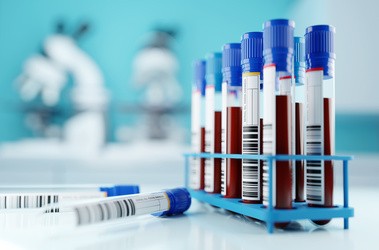 Rząd próbek ludzkiej krwi w laboratorum. Próbki rkwi w fiolkach gotowe do zbadania.