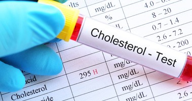 Badanie poziomu cholesterolu