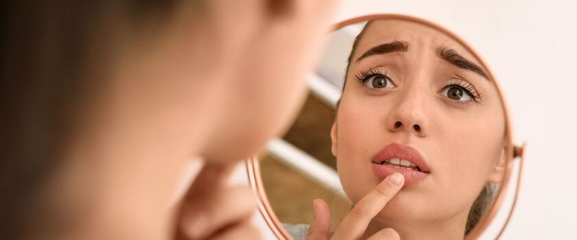 Kobieta przegląda się w lustrze i dotyka ust. Opryszczka wargowa, opryszczka na ustach.