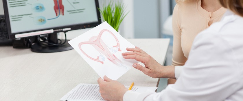 Lekarz ginekolog pokazuje pacjentce ilustrację, na której znajdują się kobiece narządy rozrodcze