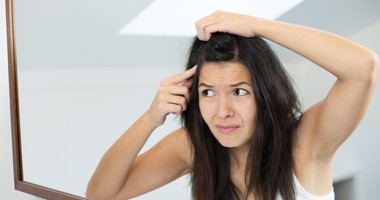 Sucha skóra głowy – przyczyny przesuszonej skóry głowy. Jakie są sposoby na nawilżenie skóry głowy?