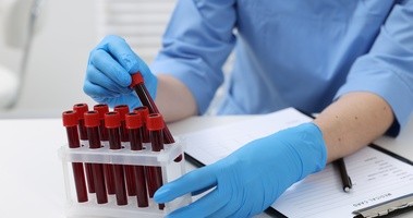 mutacje BRCA, mutacje genetyczne, nowotwór BRCA, badanie NGS