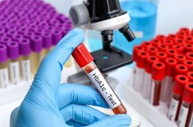 hemoglobina glikowana, badanie hemoglobiny glikowanej, badanie cukru, poziom cukru we krwi