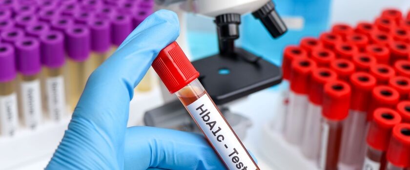 hemoglobina glikowana, badanie hemoglobiny glikowanej, badanie cukru, poziom cukru we krwi
