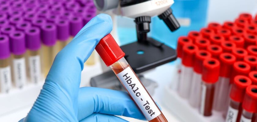 hemoglobina glikowana, badanie hemoglobiny glikowanej, badanie cukru, poziom cukru we krwi