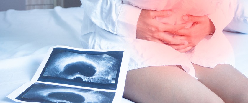 Kobieta trzymająca się za brzuch patrzy na zdjęcie USG macicy